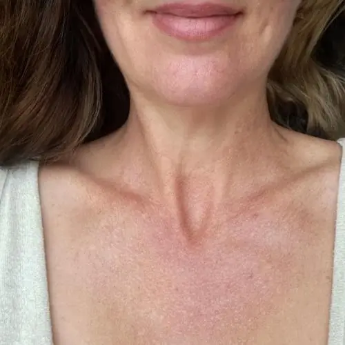 franzisuchtsex6 image 0